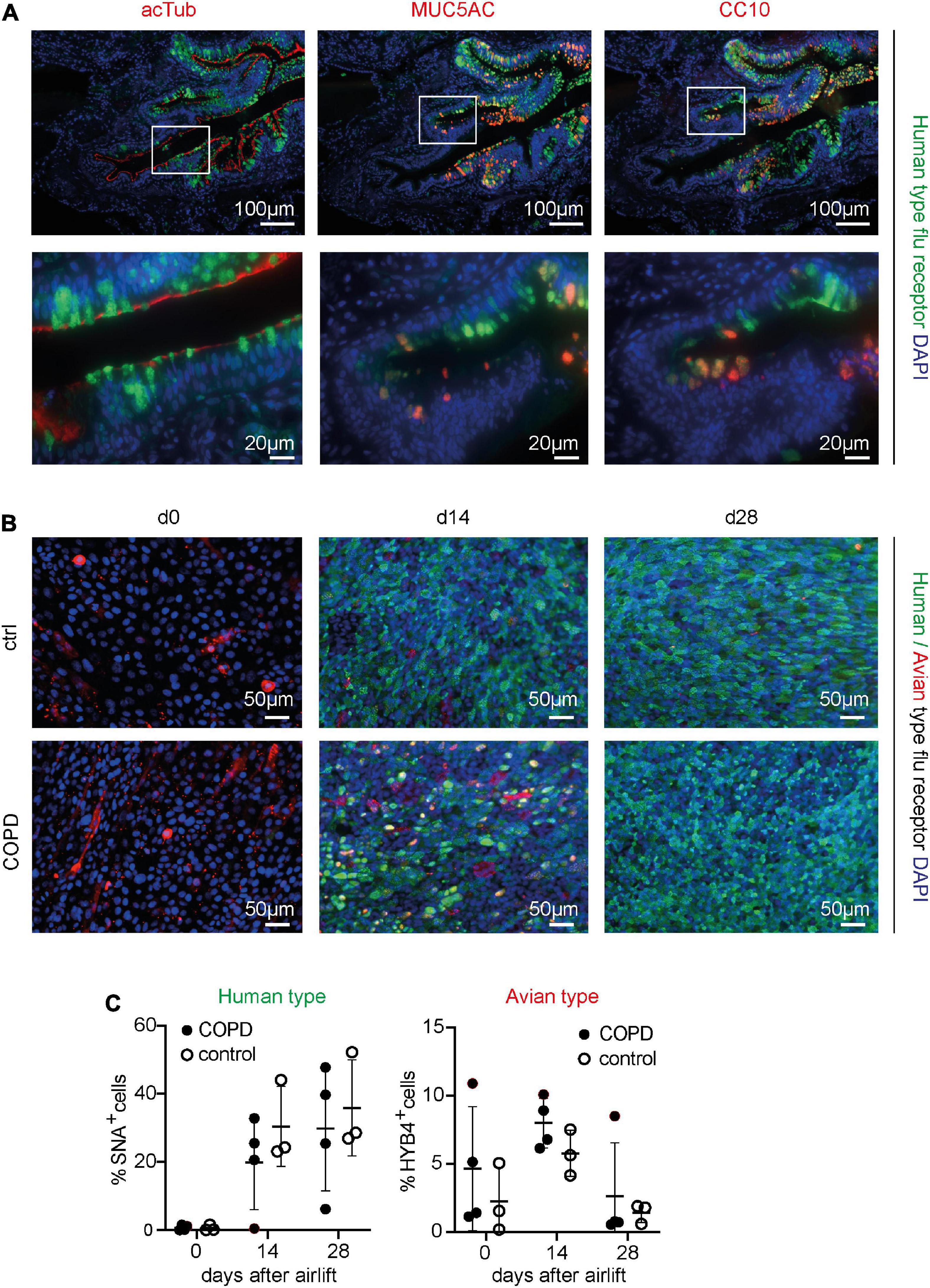 Quantitative proteomics of differentiated primary bronchial epithelial cells from chronic obstructive pulmonary disease and control identifies potential novel host factors post-influenza A virus infection